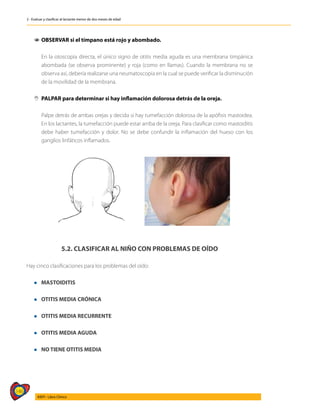 146
AIEPI - Libro Clínico
2 - Evaluar y clasificar al lactante menor de dos meses de edad
1
1 OBSERVAR si el tímpano está rojo y abombado.
	 En la otoscopia directa, el único signo de otitis media aguda es una membrana timpánica
abombada (se observa prominente) y roja (como en llamas). Cuando la membrana no se
observa así, debería realizarse una neumatoscopia en la cual se puede verificar la disminución
de la movilidad de la membrana.
,
, PALPAR para determinar si hay inflamación dolorosa detrás de la oreja.
	 Palpe detrás de ambas orejas y decida si hay tumefacción dolorosa de la apófisis mastoidea.
En los lactantes, la tumefacción puede estar arriba de la oreja. Para clasificar como mastoiditis
debe haber tumefacción y dolor. No se debe confundir la inflamación del hueso con los
ganglios linfáticos inflamados.
5.2. CLASIFICAR AL NIÑO CON PROBLEMAS DE OÍDO
Hay cinco clasificaciones para los problemas del oído:
l MASTOIDITIS
l OTITIS MEDIA CRÓNICA
l OTITIS MEDIA RECURRENTE
l OTITIS MEDIA AGUDA
l NO TIENE OTITIS MEDIA
 