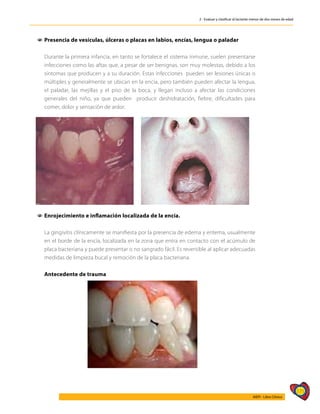171
AIEPI - Libro Clínico
2 - Evaluar y clasificar al lactante menor de dos meses de edad
1
1 Presencia de vesículas, úlceras o placas en labios, encías, lengua o paladar
	
	 Durante la primera infancia, en tanto se fortalece el sistema inmune, suelen presentarse
infecciones como las aftas que, a pesar de ser benignas, son muy molestas, debido a los
síntomas que producen y a su duración. Estas infecciones pueden ser lesiones únicas o
múltiples y generalmente se ubican en la encía, pero también pueden afectar la lengua,
el paladar, las mejillas y el piso de la boca, y llegan incluso a afectar las condiciones
generales del niño, ya que pueden producir deshidratación, fiebre, dificultades para
comer, dolor y sensación de ardor.
1
1 Enrojecimiento e inflamación localizada de la encía.
	 La gingivitis clínicamente se manifiesta por la presencia de edema y eritema, usualmente
en el borde de la encía, localizada en la zona que entra en contacto con el acúmulo de
placa bacteriana y puede presentar o no sangrado fácil. Es reversible al aplicar adecuadas
medidas de limpieza bucal y remoción de la placa bacteriana.
	 Antecedente de trauma
 