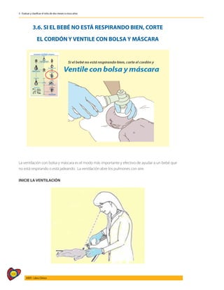 390
AIEPI - Libro Clínico
3 - Evaluar y clasificar el niño de dos meses a cinco años
3.6. SI EL BEBÉ NO ESTÁ RESPIRANDO BIEN, CORTE
EL CORDÓN Y VENTILE CON BOLSA Y MÁSCARA
La ventilación con bolsa y máscara es el modo más importante y efectivo de ayudar a un bebé que
no está respirando o está jadeando. La ventilación abre los pulmones con aire.
INICIE LA VENTILACIÓN
 