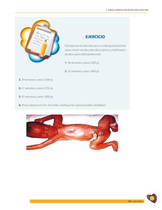 427
AIEPI - Libro Clínico
3 - Evaluar y clasificar el niño de dos meses a cinco años
	
EJERCICIO
Este ejercicio le describe pesos y edad gestacional de
varios recién nacidos; describa cuál es su clasificación
de peso para edad gestacional:
1. 38 semanas y peso 2200 gr.
2. 35 semanas y peso 1800 gr.
3. 39 semanas y peso 2500 gr.
4. 31 semanas y peso 2250 gr.
5. 43 semanas y peso 2800 gr.
6. Ahora observe el niño de la foto, clasifique los signos posibles del Ballard
 