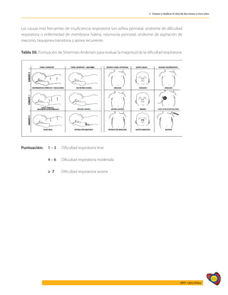 439
AIEPI - Libro Clínico
3 - Evaluar y clasificar el niño de dos meses a cinco años
Las causas más frecuentes de insuficiencia respiratoria son asfixia perinatal, síndrome de dificultad
respiratoria o enfermedad de membrana hialina, neumonía perinatal, síndrome de aspiración de
meconio, taquipnea transitoria y apnea recurrente.
Tabla 50. Puntuación de Silverman-Andersen para evaluar la magnitud de la dificultad respiratoria
Puntuación: 	1 – 3	 Dificultad respiratoria leve
	 4 – 6	 Dificultad respiratoria moderada
	 ≥ 7	 Dificultad respiratoria severa
 