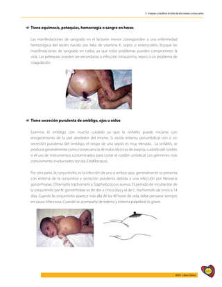 447
AIEPI - Libro Clínico
3 - Evaluar y clasificar el niño de dos meses a cinco años
1
1 	
Tiene equimosis, petequias, hemorragia o sangre en heces
	 Las manifestaciones de sangrado en el lactante menor corresponden a una enfermedad
hemorrágica del recién nacido por falta de vitamina K, sepsis o enterocolitis. Busque las
manifestaciones de sangrado en todos, ya que estos problemas pueden comprometer la
vida. Las petequias pueden ser secundarias a infección intrauterina, sepsis o un problema de
coagulación.
1
1 Tiene secreción purulenta de ombligo, ojos u oídos
	 Examine el ombligo con mucho cuidado ya que la onfalitis puede iniciarse con
enrojecimiento de la piel alrededor del mismo. Si existe eritema periumbilical con o sin
secreción purulenta del ombligo, el riesgo de una sepsis es muy elevado. La onfalitis, se
produce generalmente como consecuencia de malas técnicas de asepsia, cuidado del cordón
o el uso de instrumentos contaminados para cortar el cordón umbilical. Los gérmenes más
comúnmente involucrados son los Estafilococos.
	 Por otra parte, la conjuntivitis, es la infección de uno o ambos ojos, generalmente se presenta
con eritema de la conjuntiva y secreción purulenta debida a una infección por Neisseria
gonorrhoeae, Chlamydia trachomatis y Staphylococcus aureus. El período de incubación de
la conjuntivitis por N. gonorrhoeae es de dos a cinco días y el de C. trachomatis de cinco a 14
días. Cuando la conjuntivitis aparece más allá de las 48 horas de vida, debe pensarse siempre
en causa infecciosa. Cuando se acompaña de edema y eritema palpebral es grave.
	
 