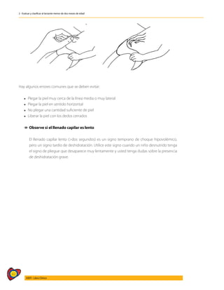 92
AIEPI - Libro Clínico
2 - Evaluar y clasificar al lactante menor de dos meses de edad
Hay algunos errores comunes que se deben evitar:
l Plegar la piel muy cerca de la línea media o muy lateral
l Plegar la piel en sentido horizontal
l No plegar una cantidad suficiente de piel
l Liberar la piel con los dedos cerrados
1
1 Observe si el llenado capilar es lento
	
	 El llenado capilar lento (>dos segundos) es un signo temprano de choque hipovolémico,
pero un signo tardío de deshidratación. Utilice este signo cuando un niño desnutrido tenga
el signo de pliegue que desaparece muy lentamente y usted tenga dudas sobre la presencia
de deshidratación grave.
 