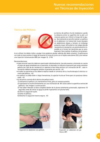 Nuevas recomendaciones
en Técnicas de Inyección
13
Técnica del Pellizco:
La técnica de pellizco ha de emplearse cuando
la distancia entre la superficie de la piel y el
músculo parece ser inferior al largo de la agu-
ja. Normalmente es sencillo realizar un pellizco
en el abdomen ó el lateral del muslo (excepto
en abdómenes obesos y tensos), sin embargo
presenta mayor dificultad en las nalgas (donde
raramente es necesario) y es prácticamente im-
posible en el brazo (en pacientes que se auto-
inyectan). Para realizar el pellizco correctamen-
te se utilizan los dedos índice y pulgar (nos podemos ayudar además del dedo corazón). Si pellizcamos
con toda la mano existe el riesgo de levantar el músculo junto con el tejido subcutáneo (SC) y de realizar
una inyección intramuscular (IM) (ver imagen 3). (119)
Recomendaciones:
•	Cada zona de inyección debe ser examinada individualmente, tras este examen y teniendo en cuenta
el largo de aguja empleado por el paciente, el educador le indicará al paciente qué zonas necesitan
pellizco (en caso de ser necesario) y si además le hace falta pinchar con inclinación de 45º…esta in-
formación deberá entregarse siempre al paciente por escrito. A3
•	A todos los pacientes se les debería explicar desde el comienzo de su insulinoterapia la técnica co-
rrecta del pellizco. A3
•	Un pellizco no debe doler ni dejar hematomas, la sujeción ha de ser firme pero sin presionar dema-
siado. A3
•	La secuencia correcta de la técnica de pellizco sería:  
1) realizamos el pellizco y lo mantenemos firme, pero sin excesiva presión;
2) inyectamos la insulina lentamente con una inclinación de  90° (recto sobre la superficie central del
pellizco); (ver imagen a continuación)
3) Tras haber liberado la dosis completa (botón de la pluma totalmente presionado, esperamos 10
segundos antes de retirar la aguja (cuando inyectamos con pluma/ boli);
4) retirar la aguja de la piel;
5) Soltar el pellizco;
6) Desechar la aguja de manera segura. A3
Inyección en abdomen con pellizco. Inyección en abdomen sin pe-
llizco a 90º.
 