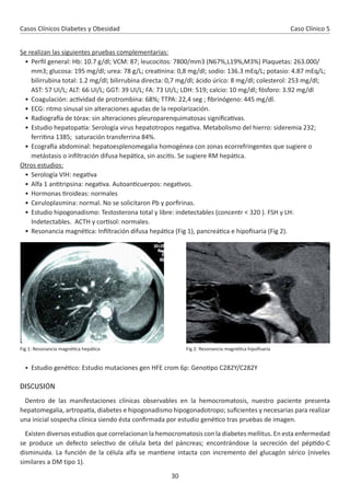 30
Casos Clínicos Diabetes y Obesidad
Se realizan las siguientes pruebas complementarias:
• Perﬁl general: Hb: 10.7 g/dl; VCM: 87; leucocitos: 7800/mm3 (N67%,L19%,M3%) Plaquetas: 263.000/
mm3; glucosa: 195 mg/dl; urea: 78 g/L; crea nina: 0,8 mg/dl; sodio: 136.3 mEq/L; potasio: 4.87 mEq/L;
bilirrubina total: 1.2 mg/dl; bilirrubina directa: 0,7 mg/dl; ácido úrico: 8 mg/dl; colesterol: 253 mg/dl;
AST: 57 UI/L; ALT: 66 UI/L; GGT: 39 UI/L; FA: 73 UI/L; LDH: 519; calcio: 10 mg/dl; fósforo: 3.92 mg/dl
• Coagulación: ac vidad de protrombina: 68%; TTPA: 22,4 seg ; ﬁbrinógeno: 445 mg/dl.
• ECG: ritmo sinusal sin alteraciones agudas de la repolarización.
• Radiogra a de tórax: sin alteraciones pleuroparenquimatosas signiﬁca vas.
• Estudio hepatopa a: Serología virus hepatotropos nega va. Metabolismo del hierro: sideremia 232;
ferri na 1385; saturación transferrina 84%.
• Ecogra a abdominal: hepatoesplenomegalia homogénea con zonas ecorrefringentes que sugiere o
metástasis o inﬁltración difusa hepá ca, sin asci s. Se sugiere RM hepá ca.
Otros estudios:
• Serología VIH: nega va
• Alfa 1 an tripsina: nega va. Autoan cuerpos: nega vos.
• Hormonas roideas: normales
• Ceruloplasmina: normal. No se solicitaron Pb y porﬁrinas.
• Estudio hipogonadismo: Testosterona total y libre: indetectables (concentr < 320 ). FSH y LH:
Indetectables. ACTH y cor sol: normales.
• Resonancia magné ca: Inﬁltración difusa hepá ca (Fig 1), pancreá ca e hipoﬁsaria (Fig 2).
• Estudio gené co: Estudio mutaciones gen HFE crom 6p: Geno po C282Y/C282Y
DISCUSIÓN
Dentro de las manifestaciones clínicas observables en la hemocromatosis, nuestro paciente presenta
hepatomegalia, artropa a, diabetes e hipogonadismo hipogonadotropo; suﬁcientes y necesarias para realizar
una inicial sospecha clínica siendo ésta conﬁrmada por estudio gené co tras pruebas de imagen.
Existen diversos estudios que correlacionan la hemocromatosis con la diabetes mellitus. En esta enfermedad
se produce un defecto selec vo de célula beta del páncreas; encontrándose la secreción del pép do-C
disminuida. La función de la célula alfa se man ene intacta con incremento del glucagón sérico (niveles
similares a DM tipo 1).
Fig 1: Resonancia magné ca hepá ca Fig 2: Resonancia magné ca hipoﬁsaria
Caso Clínico 5
 