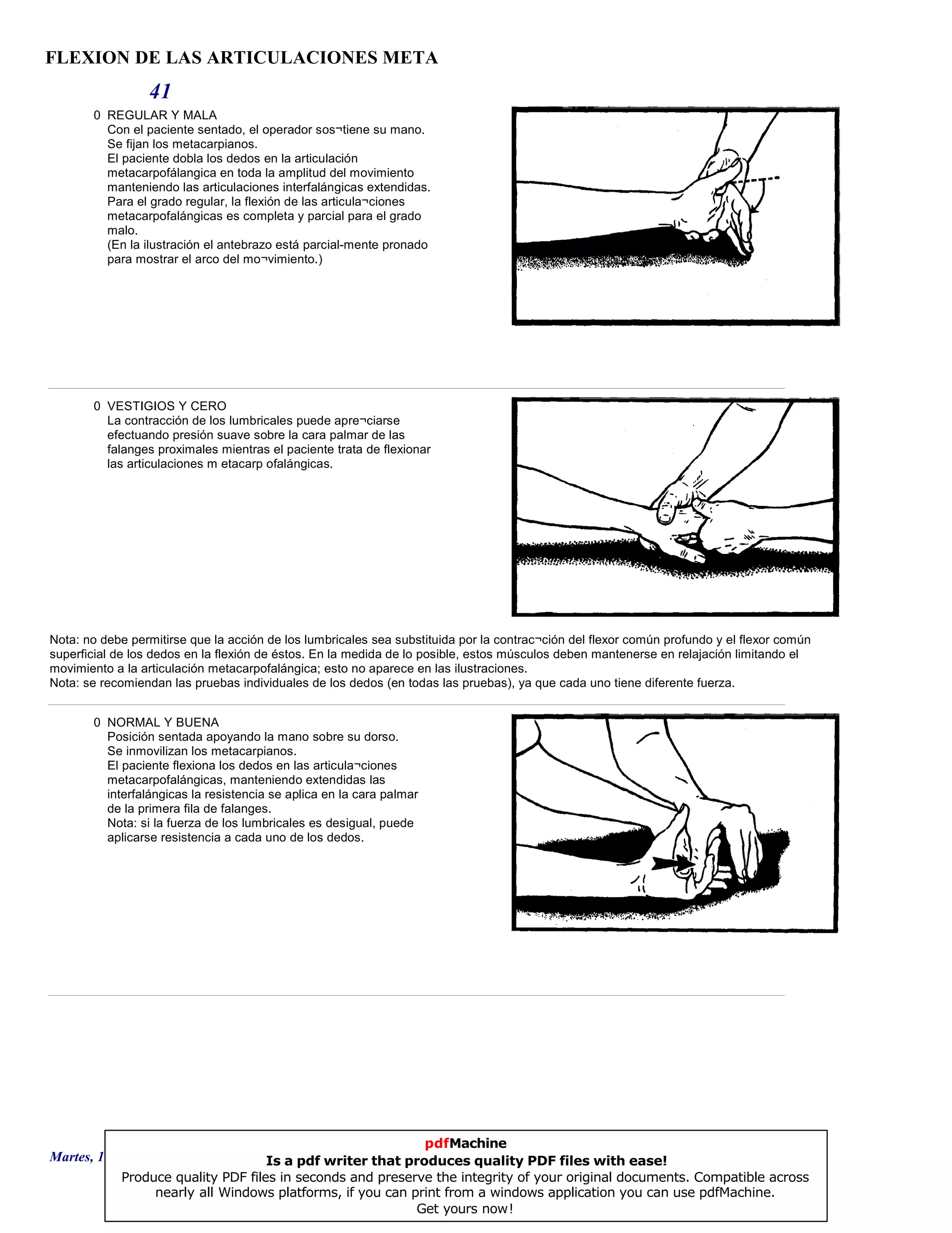 FLEXION DE LAS ARTICULACIONES META
41
0 REGULAR Y MALA
Con el paciente sentado, el operador sos¬tiene su mano.
Se fijan los metacarpianos.
El paciente dobla los dedos en la articulación
metacarpofálangica en toda la amplitud del movimiento
manteniendo las articulaciones interfalángicas extendidas.
Para el grado regular, la flexión de las articula¬ciones
metacarpofalángicas es completa y parcial para el grado
malo.
(En la ilustración el antebrazo está parcial-mente pronado
para mostrar el arco del mo¬vimiento.)
0 VESTIGIOS Y CERO
La contracción de los lumbricales puede apre¬ciarse
efectuando presión suave sobre la cara palmar de las
falanges proximales mientras el paciente trata de flexionar
las articulaciones m etacarp ofalángicas.
Nota: no debe permitirse que la acción de los lumbricales sea substituida por la contrac¬ción del flexor común profundo y el flexor común
superficial de los dedos en la flexión de éstos. En la medida de lo posible, estos músculos deben mantenerse en relajación limitando el
movimiento a la articulación metacarpofalángica; esto no aparece en las ilustraciones.
Nota: se recomiendan las pruebas individuales de los dedos (en todas las pruebas), ya que cada uno tiene diferente fuerza.
0 NORMAL Y BUENA
Posición sentada apoyando la mano sobre su dorso.
Se inmovilizan los metacarpianos.
El paciente flexiona los dedos en las articula¬ciones
metacarpofalángicas, manteniendo extendidas las
interfalángicas la resistencia se aplica en la cara palmar
de la primera fila de falanges.
Nota: si la fuerza de los lumbricales es desigual, puede
aplicarse resistencia a cada uno de los dedos.
Martes, 18 de Septiembre de 2007 Página 114 de 135
pdfMachine
Is a pdf writer that produces quality PDF files with ease!
Produce quality PDF files in seconds and preserve the integrity of your original documents. Compatible across
nearly all Windows platforms, if you can print from a windows application you can use pdfMachine.
Get yours now!
 