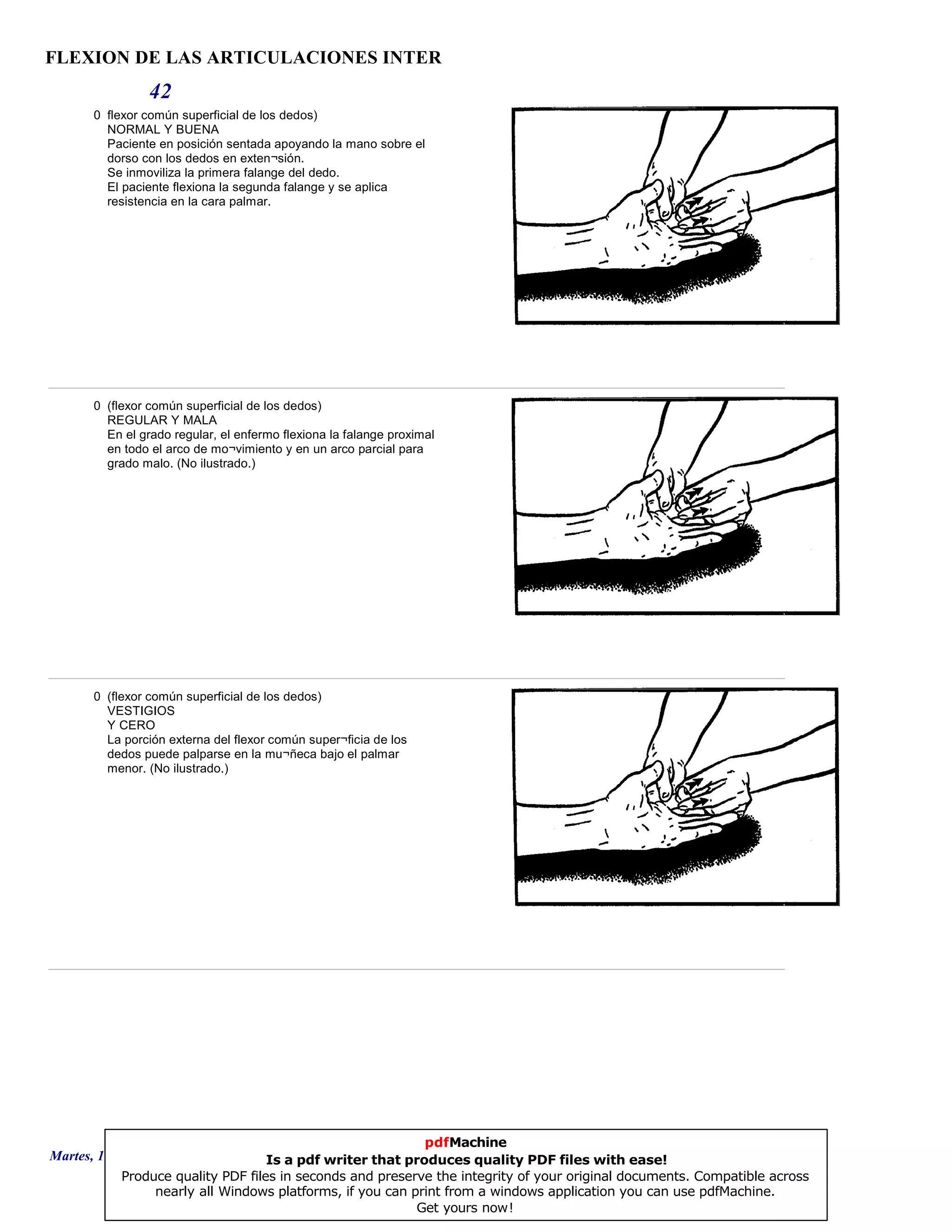 FLEXION DE LAS ARTICULACIONES INTER
42
0 flexor común superficial de los dedos)
NORMAL Y BUENA
Paciente en posición sentada apoyando la mano sobre el
dorso con los dedos en exten¬sión.
Se inmoviliza la primera falange del dedo.
El paciente flexiona la segunda falange y se aplica
resistencia en la cara palmar.
0 (flexor común superficial de los dedos)
REGULAR Y MALA
En el grado regular, el enfermo flexiona la falange proximal
en todo el arco de mo¬vimiento y en un arco parcial para
grado malo. (No ilustrado.)
0 (flexor común superficial de los dedos)
VESTIGIOS
Y CERO
La porción externa del flexor común super¬ficia de los
dedos puede palparse en la mu¬ñeca bajo el palmar
menor. (No ilustrado.)
Martes, 18 de Septiembre de 2007 Página 116 de 135
pdfMachine
Is a pdf writer that produces quality PDF files with ease!
Produce quality PDF files in seconds and preserve the integrity of your original documents. Compatible across
nearly all Windows platforms, if you can print from a windows application you can use pdfMachine.
Get yours now!
 