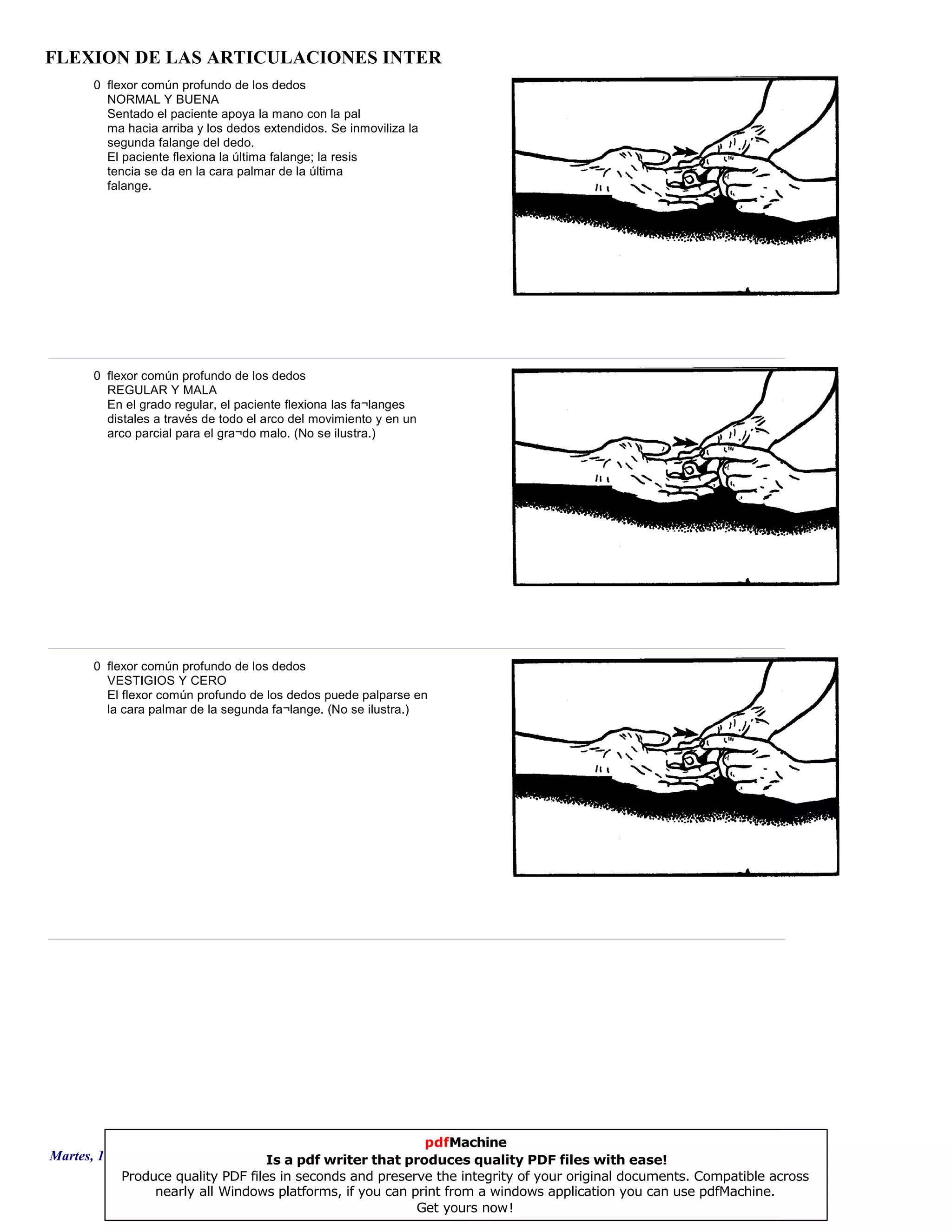 FLEXION DE LAS ARTICULACIONES INTER
0 flexor común profundo de los dedos
NORMAL Y BUENA
Sentado el paciente apoya la mano con la pal
ma hacia arriba y los dedos extendidos. Se inmoviliza la
segunda falange del dedo.
El paciente flexiona la última falange; la resis
tencia se da en la cara palmar de la última
falange.
0 flexor común profundo de los dedos
REGULAR Y MALA
En el grado regular, el paciente flexiona las fa¬langes
distales a través de todo el arco del movimiento y en un
arco parcial para el gra¬do malo. (No se ilustra.)
0 flexor común profundo de los dedos
VESTIGIOS Y CERO
El flexor común profundo de los dedos puede palparse en
la cara palmar de la segunda fa¬lange. (No se ilustra.)
Martes, 18 de Septiembre de 2007 Página 117 de 135
pdfMachine
Is a pdf writer that produces quality PDF files with ease!
Produce quality PDF files in seconds and preserve the integrity of your original documents. Compatible across
nearly all Windows platforms, if you can print from a windows application you can use pdfMachine.
Get yours now!
 
