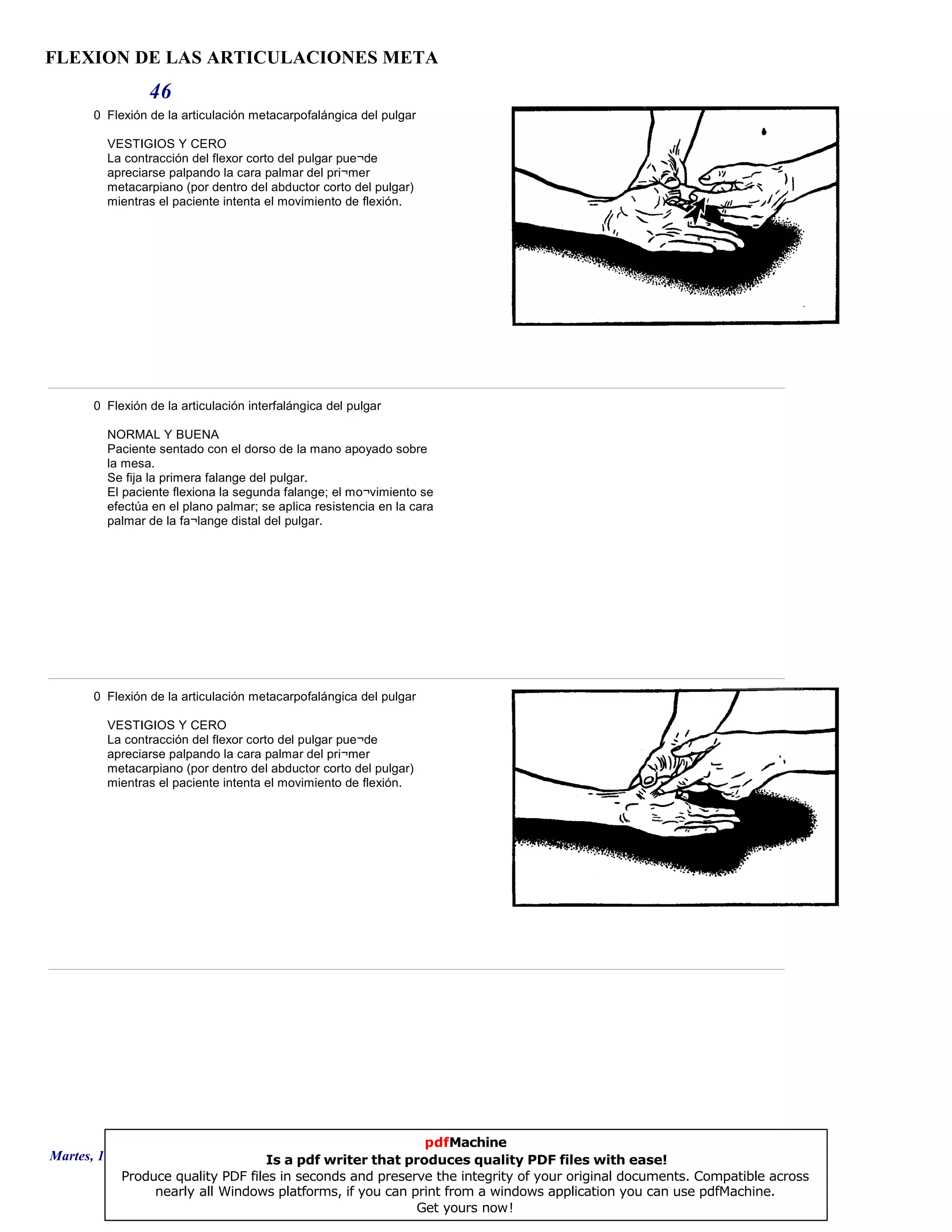 FLEXION DE LAS ARTICULACIONES META
46
0 Flexión de la articulación metacarpofalángica del pulgar
VESTIGIOS Y CERO
La contracción del flexor corto del pulgar pue¬de
apreciarse palpando la cara palmar del pri¬mer
metacarpiano (por dentro del abductor corto del pulgar)
mientras el paciente intenta el movimiento de flexión.
0 Flexión de la articulación interfalángica del pulgar
NORMAL Y BUENA
Paciente sentado con el dorso de la mano apoyado sobre
la mesa.
Se fija la primera falange del pulgar.
El paciente flexiona la segunda falange; el mo¬vimiento se
efectúa en el plano palmar; se aplica resistencia en la cara
palmar de la fa¬lange distal del pulgar.
0 Flexión de la articulación metacarpofalángica del pulgar
VESTIGIOS Y CERO
La contracción del flexor corto del pulgar pue¬de
apreciarse palpando la cara palmar del pri¬mer
metacarpiano (por dentro del abductor corto del pulgar)
mientras el paciente intenta el movimiento de flexión.
Martes, 18 de Septiembre de 2007 Página 127 de 135
pdfMachine
Is a pdf writer that produces quality PDF files with ease!
Produce quality PDF files in seconds and preserve the integrity of your original documents. Compatible across
nearly all Windows platforms, if you can print from a windows application you can use pdfMachine.
Get yours now!
 