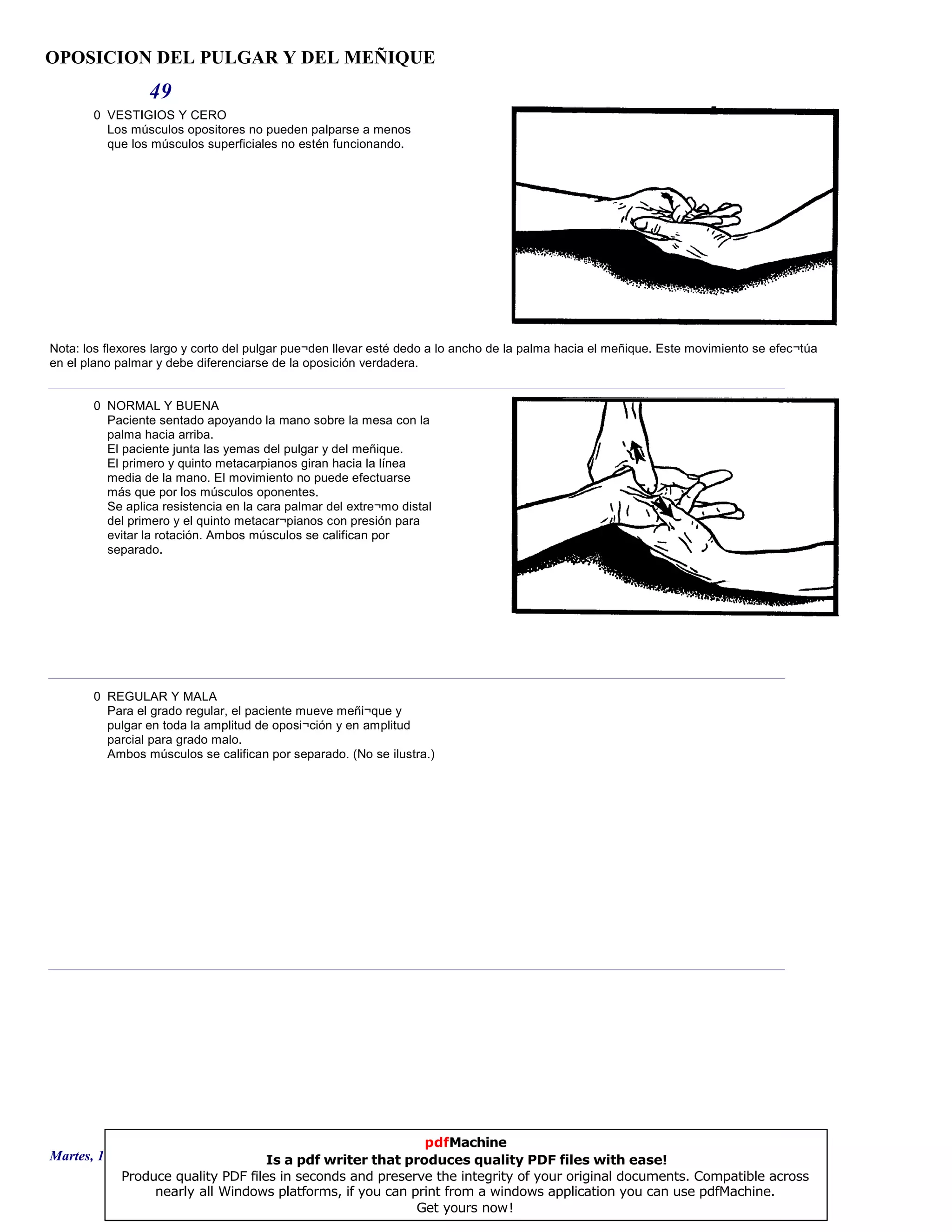 OPOSICION DEL PULGAR Y DEL MEÑIQUE
49
0 VESTIGIOS Y CERO
Los músculos opositores no pueden palparse a menos
que los músculos superficiales no estén funcionando.
Nota: los flexores largo y corto del pulgar pue¬den llevar esté dedo a lo ancho de la palma hacia el meñique. Este movimiento se efec¬túa
en el plano palmar y debe diferenciarse de la oposición verdadera.
0 NORMAL Y BUENA
Paciente sentado apoyando la mano sobre la mesa con la
palma hacia arriba.
El paciente junta las yemas del pulgar y del meñique.
El primero y quinto metacarpianos giran hacia la línea
media de la mano. El movimiento no puede efectuarse
más que por los músculos oponentes.
Se aplica resistencia en la cara palmar del extre¬mo distal
del primero y el quinto metacar¬pianos con presión para
evitar la rotación. Ambos músculos se califican por
separado.
0 REGULAR Y MALA
Para el grado regular, el paciente mueve meñi¬que y
pulgar en toda la amplitud de oposi¬ción y en amplitud
parcial para grado malo.
Ambos músculos se califican por separado. (No se ilustra.)
Martes, 18 de Septiembre de 2007 Página 135 de 135
pdfMachine
Is a pdf writer that produces quality PDF files with ease!
Produce quality PDF files in seconds and preserve the integrity of your original documents. Compatible across
nearly all Windows platforms, if you can print from a windows application you can use pdfMachine.
Get yours now!
 