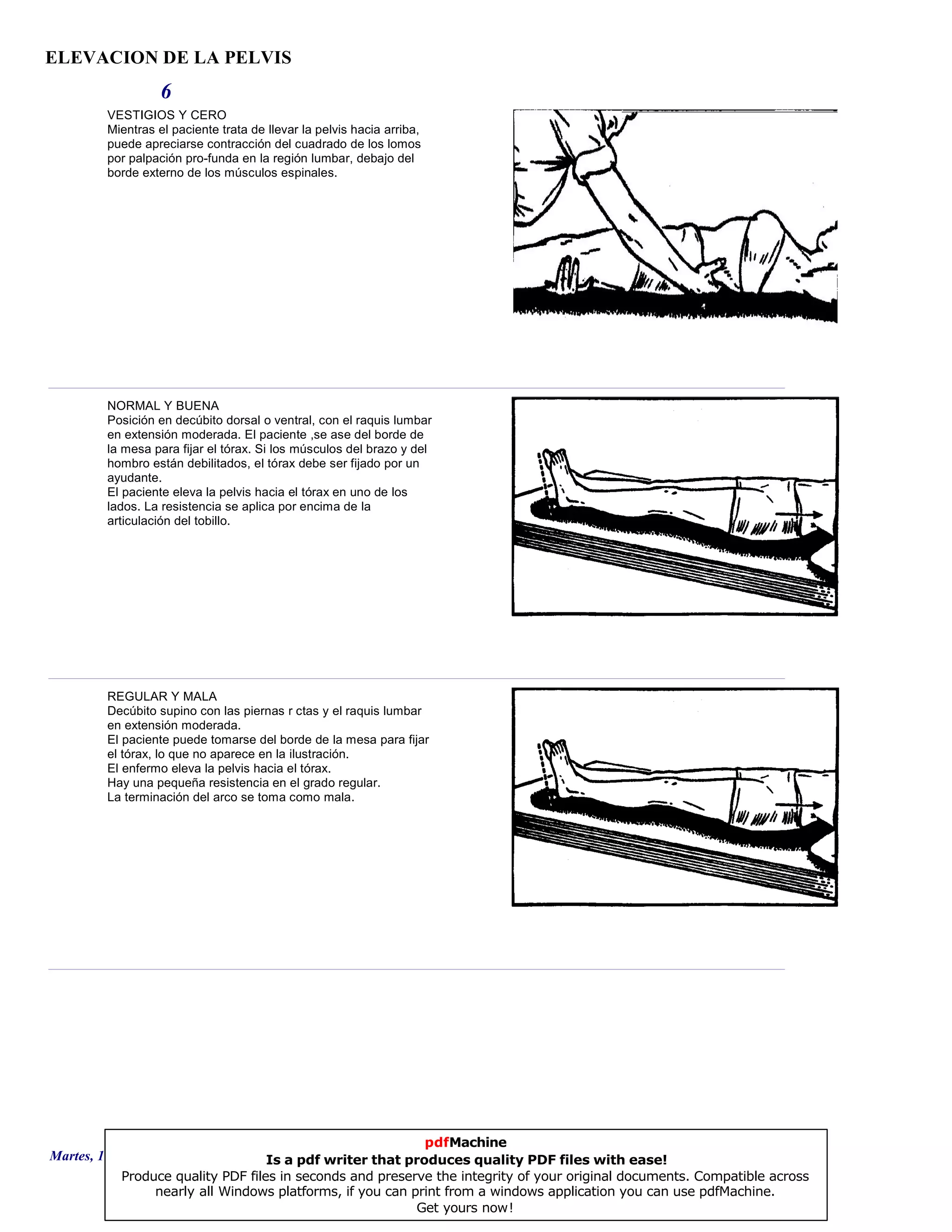 ELEVACION DE LA PELVIS
6
VESTIGIOS Y CERO
Mientras el paciente trata de llevar la pelvis hacia arriba,
puede apreciarse contracción del cuadrado de los lomos
por palpación pro-funda en la región lumbar, debajo del
borde externo de los músculos espinales.
NORMAL Y BUENA
Posición en decúbito dorsal o ventral, con el raquis lumbar
en extensión moderada. El paciente ,se ase del borde de
la mesa para fijar el tórax. Si los músculos del brazo y del
hombro están debilitados, el tórax debe ser fijado por un
ayudante.
El paciente eleva la pelvis hacia el tórax en uno de los
lados. La resistencia se aplica por encima de la
articulación del tobillo.
REGULAR Y MALA
Decúbito supino con las piernas r ctas y el raquis lumbar
en extensión moderada.
El paciente puede tomarse del borde de la mesa para fijar
el tórax, lo que no aparece en la ilustración.
El enfermo eleva la pelvis hacia el tórax.
Hay una pequeña resistencia en el grado regular.
La terminación del arco se toma como mala.
Martes, 18 de Septiembre de 2007 Página 16 de 135
pdfMachine
Is a pdf writer that produces quality PDF files with ease!
Produce quality PDF files in seconds and preserve the integrity of your original documents. Compatible across
nearly all Windows platforms, if you can print from a windows application you can use pdfMachine.
Get yours now!
 