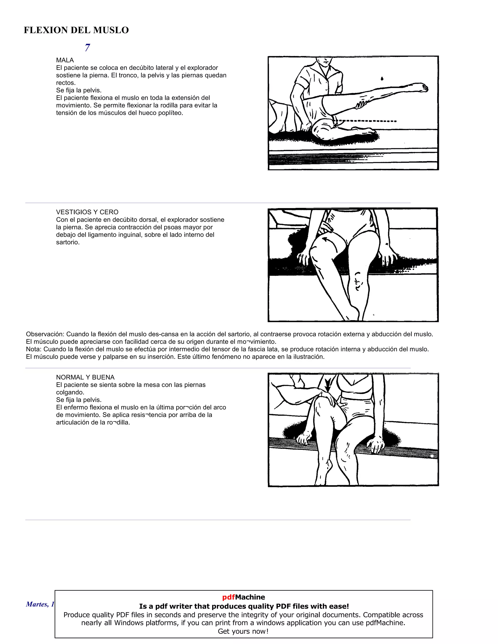 FLEXION DEL MUSLO
7
MALA
El paciente se coloca en decúbito lateral y el explorador
sostiene la pierna. El tronco, la pelvis y las piernas quedan
rectos.
Se fija la pelvis.
El paciente flexiona el muslo en toda la extensión del
movimiento. Se permite flexionar la rodilla para evitar la
tensión de los músculos del hueco poplíteo.
VESTIGIOS Y CERO
Con el paciente en decúbito dorsal, el explorador sostiene
la pierna. Se aprecia contracción del psoas mayor por
debajo del ligamento inguinal, sobre el lado interno del
sartorio.
Observación: Cuando la flexión del muslo des-cansa en la acción del sartorio, al contraerse provoca rotación externa y abducción del muslo.
El músculo puede apreciarse con facilidad cerca de su origen durante el mo¬vimiento.
Nota: Cuando la flexión del muslo se efectúa por intermedio del tensor de la fascia lata, se produce rotación interna y abducción del muslo.
El músculo puede verse y palparse en su inserción. Este último fenómeno no aparece en la ilustración.
NORMAL Y BUENA
El paciente se sienta sobre la mesa con las piernas
colgando.
Se fija la pelvis.
El enfermo flexiona el muslo en la última por¬ción del arco
de movimiento. Se aplica resis¬tencia por arriba de la
articulación de la ro¬dilla.
Martes, 18 de Septiembre de 2007 Página 19 de 135
pdfMachine
Is a pdf writer that produces quality PDF files with ease!
Produce quality PDF files in seconds and preserve the integrity of your original documents. Compatible across
nearly all Windows platforms, if you can print from a windows application you can use pdfMachine.
Get yours now!
 