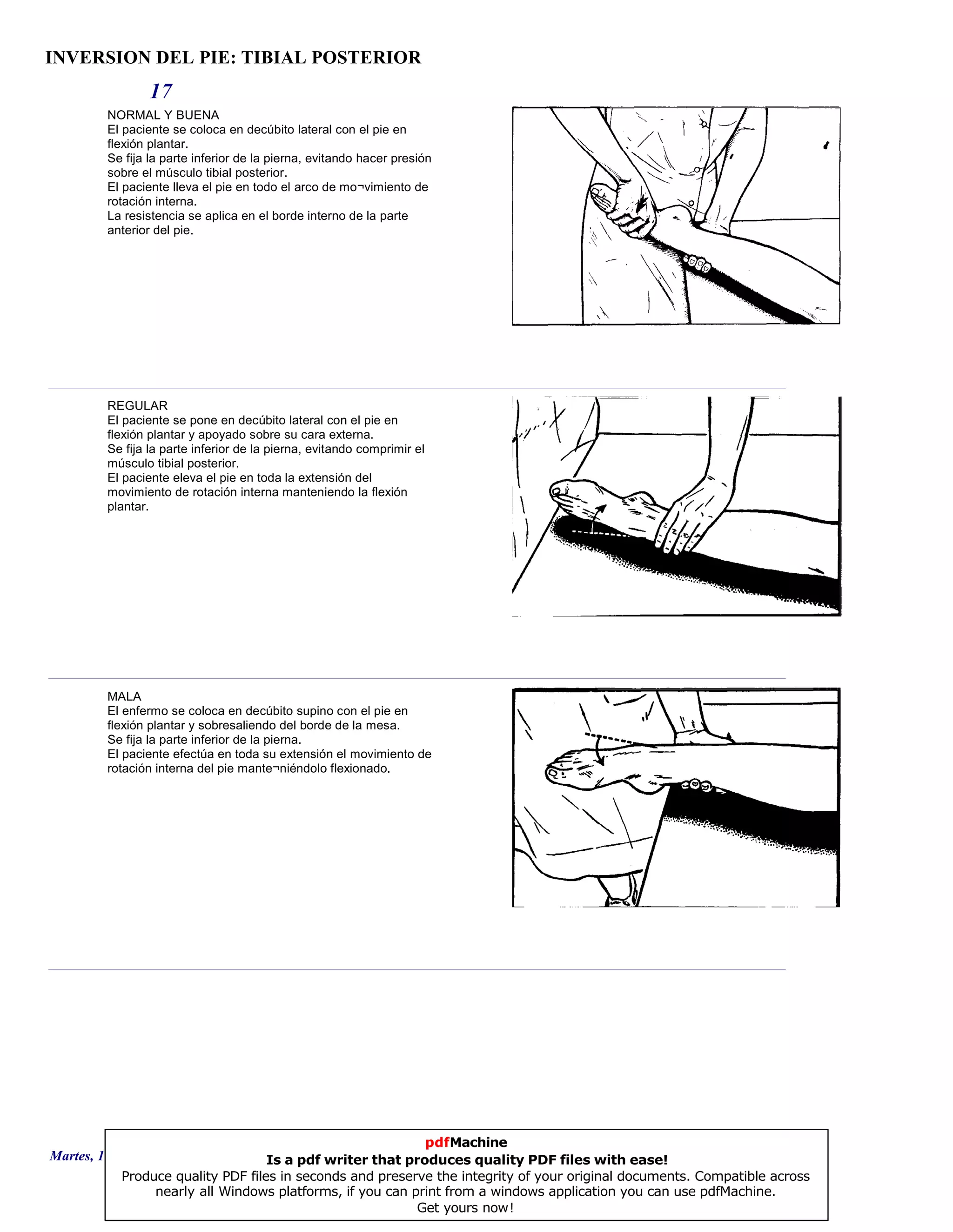 INVERSION DEL PIE: TIBIAL POSTERIOR
17
NORMAL Y BUENA
El paciente se coloca en decúbito lateral con el pie en
flexión plantar.
Se fija la parte inferior de la pierna, evitando hacer presión
sobre el músculo tibial posterior.
El paciente lleva el pie en todo el arco de mo¬vimiento de
rotación interna.
La resistencia se aplica en el borde interno de la parte
anterior del pie.
REGULAR
El paciente se pone en decúbito lateral con el pie en
flexión plantar y apoyado sobre su cara externa.
Se fija la parte inferior de la pierna, evitando comprimir el
músculo tibial posterior.
El paciente eleva el pie en toda la extensión del
movimiento de rotación interna manteniendo la flexión
plantar.
MALA
El enfermo se coloca en decúbito supino con el pie en
flexión plantar y sobresaliendo del borde de la mesa.
Se fija la parte inferior de la pierna.
El paciente efectúa en toda su extensión el movimiento de
rotación interna del pie mante¬niéndolo flexionado.
Martes, 18 de Septiembre de 2007 Página 48 de 135
pdfMachine
Is a pdf writer that produces quality PDF files with ease!
Produce quality PDF files in seconds and preserve the integrity of your original documents. Compatible across
nearly all Windows platforms, if you can print from a windows application you can use pdfMachine.
Get yours now!
 