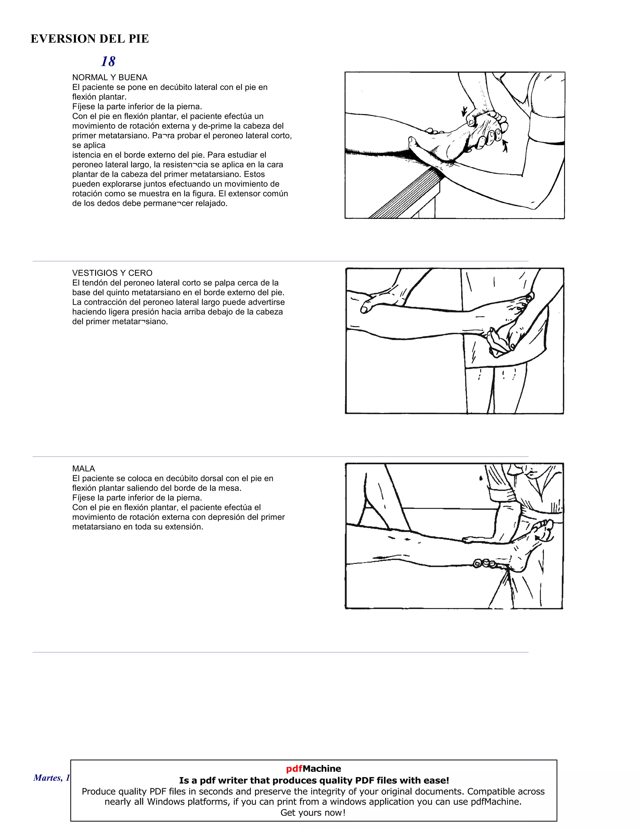 EVERSION DEL PIE
18
NORMAL Y BUENA
El paciente se pone en decúbito lateral con el pie en
flexión plantar.
Fíjese la parte inferior de la pierna.
Con el pie en flexión plantar, el paciente efectúa un
movimiento de rotación externa y de-prime la cabeza del
primer metatarsiano. Pa¬ra probar el peroneo lateral corto,
se aplica
istencia en el borde externo del pie. Para estudiar el
peroneo lateral largo, la resisten¬cia se aplica en la cara
plantar de la cabeza del primer metatarsiano. Estos
pueden explorarse juntos efectuando un movimiento de
rotación como se muestra en la figura. El extensor común
de los dedos debe permane¬cer relajado.
VESTIGIOS Y CERO
El tendón del peroneo lateral corto se palpa cerca de la
base del quinto metatarsiano en el borde externo del pie.
La contracción del peroneo lateral largo puede advertirse
haciendo ligera presión hacia arriba debajo de la cabeza
del primer metatar¬siano.
MALA
El paciente se coloca en decúbito dorsal con el pie en
flexión plantar saliendo del borde de la mesa.
Fíjese la parte inferior de la pierna.
Con el pie en flexión plantar, el paciente efectúa el
movimiento de rotación externa con depresión del primer
metatarsiano en toda su extensión.
Martes, 18 de Septiembre de 2007 Página 51 de 135
pdfMachine
Is a pdf writer that produces quality PDF files with ease!
Produce quality PDF files in seconds and preserve the integrity of your original documents. Compatible across
nearly all Windows platforms, if you can print from a windows application you can use pdfMachine.
Get yours now!
 