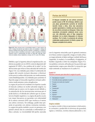 ACLS/SVCA
Introducción
140
Debido a que la isquemia afecta la repolarización, sus
efectos se pueden ver en el ECG como la depresión del
segmento ST (DST) y los cambios de la onda T en las
derivaciones que miran al área afectada del ventrículo
(figura 9.4). Los métodos para reducir la demanda de
oxígeno del corazón incluyen descansar o disminuir
la frecuencia cardíaca del paciente con medicamentos
como betabloqueantes. Los métodos para aumentar el
flujo de sangre al miocardio isquémico incluyen admi-
nistrar medicamentos como nitroglicerina.
La angina de pecho es la molestia en el pecho cuando
el músculo cardíaco no recibe suficiente oxígeno. La
molestia que se asocia con la angina ocurre debido a
la estimulación de las terminaciones nerviosas por el
ácido láctico y el dióxido de carbono que se acumu-
lan en el tejido isquémico. La angina de pecho ocurre
con mayor frecuencia en pacientes con enfermedad
de la arteria coronaria (EAC) que involucra al menos
una arteria coronaria. Sin embargo, puede estar pre-
sente en pacientes con arterias coronarias normales.
La angina de pecho también ocurre en personas con
presión arterial alta no controlada o enfermedad car-
díaca valvular. La incomodidad del pecho asociada
con la isquemia miocárdica por lo general comienza
en el tórax central o izquierdo y luego se irradia al bra-
zo (especialmente al dedo meñique [cubital] del brazo
izquierdo), la muñeca, la mandíbula, el epigastrio, el
hombro izquierdo o entre los omóplatos (Figura 9.5).
Las palabras comunes utilizadas por los pacientes que
experimentan angina para describir la sensación que
están sintiendo se muestran en el cuadro 9.1.
Cuador 9.1
Términos comunes para describir la angina de pecho
•	 “Una banda en mi pecho”
•	 “Un tornillo de banco apretando mi pecho”
•	 “Un peso en el centro de mi pecho”
•	 “Quema”
•	 “Estallido”
•	 “Constricción”
•	 “Pesadez”
•	 “Opresión”
•	 “Exprimir”
•	 “Estrangulamiento”
•	 “Sofocación”
Angina estable
La angina estable (clásica) permanece relativamen-
te constante y predecible en términos de gravedad,
signos y síntomas, eventos desencadenantes y res-
Figura 9.5. Sitios comunes para la incomodidad anginal. A, parte superior del
cofre. B, debajo del esternón que irradia al cuello y la mandíbula. C, debajo del
esternón irradiando hacia abajo del brazo izquierdo. D, Epigástrico. E, epigástrico
que irradia al cuello, la mandíbula y los brazos. F, cuello y mandíbula. G, hombro
izquierdo y brazo. H, interescapular. De Urden LD, Stacy KM, Lough ME: Enfer-
mería de cuidados críticos: diagnóstico y manejo, ed 6, St. Louis, 2010, Mosby.
Perlas del ACLS
El bloqueo completo de una arteria coronaria
puede causar un IM. Sin embargo, debido a que
una placa generalmente aumenta de tamaño
durante meses y años, otras vías vasculares
pueden agrandarse a medida que las porciones
de una arteria coronaria se bloquean. Estas vías
vasculares (circulación colateral) sirven como
una ruta alternativa para el flujo sanguíneo
alrededor de la arteria bloqueada al músculo
cardíaco. Por lo tanto, la presencia de arterias
colaterales puede prevenir el infarto a pesar del
bloqueo completo de la arteria.
 