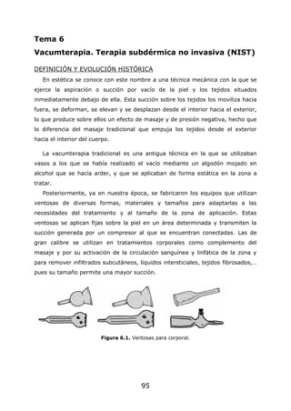 95
Tema 6
Vacumterapia. Terapia subdérmica no invasiva (NIST)
DEFINICIÓN Y EVOLUCIÓN HISTÓRICA
En estética se conoce con este nombre a una técnica mecánica con la que se
ejerce la aspiración o succión por vacío de la piel y los tejidos situados
inmediatamente debajo de ella. Esta succión sobre los tejidos los moviliza hacia
fuera, se deforman, se elevan y se desplazan desde el interior hacia el exterior,
lo que produce sobre ellos un efecto de masaje y de presión negativa, hecho que
lo diferencia del masaje tradicional que empuja los tejidos desde el exterior
hacia el interior del cuerpo.
La vacumterapia tradicional es una antigua técnica en la que se utilizaban
vasos a los que se había realizado el vacío mediante un algodón mojado en
alcohol que se hacía arder, y que se aplicaban de forma estática en la zona a
tratar.
Posteriormente, ya en nuestra época, se fabricaron los equipos que utilizan
ventosas de diversas formas, materiales y tamaños para adaptarlas a las
necesidades del tratamiento y al tamaño de la zona de aplicación. Estas
ventosas se aplican fijas sobre la piel en un área determinada y transmiten la
succión generada por un compresor al que se encuentran conectadas. Las de
gran calibre se utilizan en tratamientos corporales como complemento del
masaje y por su activación de la circulación sanguínea y linfática de la zona y
para remover infiltrados subcutáneos, líquidos intersticiales, tejidos fibrosados,…
pues su tamaño permite una mayor succión.
Figura 6.1. Ventosas para corporal.
 