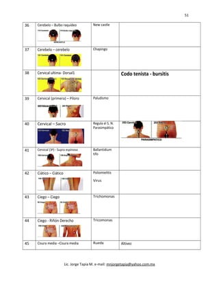51
36 Cerebelo – Bulbo raquídeo New castle
37 Cerebelo – cerebelo Chapingo
38 Cervical ultima- Dorsal1 Codo tenista - bursitis
39 Cervical (primera) – Píloro Paludismo
40 Cervical – Sacro Regula el S. N.
Parasimpático
41 Cervical (3ª) - Supra espinoso Ballantidium
tifo
42 Ciático – Ciático Poliomielitis
Virus
43 Ciego – Ciego Trichomonas
44 Ciego - Riñón Derecho Tricomonas
45 Cisura media –Cisura media Rueda Altivez
Lic. Jorge Tapia M. e-mail: mnjorgetapia@yahoo.com.mx
 