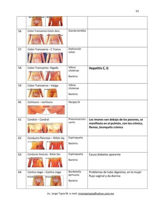 53
56 Colon Transverso–Colon desc. Giarda lamblia
57 Colon Transverso - C Transv Disfunción
colon
58 Colon Transverso- Hígado Vibrio
cholerae
Bacteria
Hepatitis C, G
59 Colon Transverso – Vejiga Vibrio
cholerae
Bacteria
60 Comisura – comisura Herpes IV
61 Condral – Condral Pneumoscistis
carini
Los imanes van debajo de los pezones, se
manifiesta en el pulmón, con tos crónica,
flemas, bronquitis crónica
62 Conducto Páncreas – Riñón izq. Espiroqueta
Bacteria
63 Conducto Vesícula - Riñón Der Espiroqueta
Bacteria
Causa diabetes aparente
64 Contra ciego – Contra ciego Bordetella
pertussis
Bacteria
Problemas de tubo digestivo, en la mujer
flujo vaginal y da diarrea
Lic. Jorge Tapia M. e-mail: mnjorgetapia@yahoo.com.mx
 