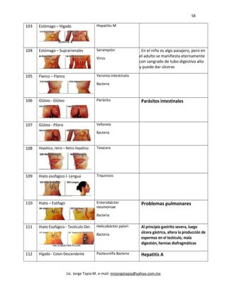 58
103 Estómago – Hígado Hepatitis M
104 Estómago – Suprarrenales Sarampión
Virus
En el niño es algo pasajero, pero en
el adulto se manifiesta eternamente
con sangrado de tubo digestivo alto
y puede dar úlceras
105 Flanco – Flanco Yersinia intestinalis
Bacteria
106 Glúteo - Glúteo Parásito. Parásitos intestinales
107 Glúteo - Píloro Vellonela
Bacteria
108 Hepático, retro – Retro hepático Toxacara
109 Hiato esofágico l- Lengua Triquinosis
110 Hiato – Esófago Enterobácter
neumoniae
Bacteria
Problemas pulmonares
111 Hiato Esofágico - Testículo Der. Helicobácter pylori
Bacteria
Al principio gastritis severa, luego
úlcera gástrica, altera la producción de
espermas en el testículo, mala
digestión, hernias diafragmáticas
112 Hígado - Colon Descendente Pasteurelfa Bacteria Hepatitis A
Lic. Jorge Tapia M. e-mail: mnjorgetapia@yahoo.com.mx
 