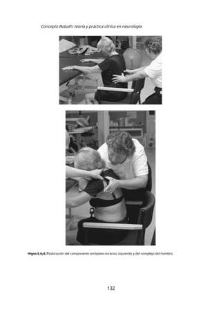 Concepto Bobath: teoría y práctica clínica en neurología
Higos 6.6y6.7Valoración del componente omóplato-torácico izquierdo y del complejo del hombro.
132
 