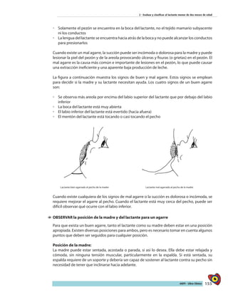 155AIEPI - Libro Clínico
2 - Evaluar y clasificar al lactante menor de dos meses de edad
◦◦ Solamente el pezón se encuentra en la boca del lactante, no el tejido mamario subyacente
ni los conductos
◦◦ La lengua del lactante se encuentra hacia atrás de la boca y no puede alcanzar los conductos
para presionarlos
Cuando existe un mal agarre, la succión puede ser incómoda o dolorosa para la madre y puede
lesionar la piel del pezón y de la areola provocando úlceras y fisuras (o grietas) en el pezón. El
mal agarre es la causa más común e importante de lesiones en el pezón, lo que puede causar
una extracción ineficiente y una aparente baja producción de leche.
La figura a continuación muestra los signos de buen y mal agarre. Estos signos se emplean
para decidir si la madre y su lactante necesitan ayuda. Los cuatro signos de un buen agarre
son:
◦◦ Se observa más areola por encima del labio superior del lactante que por debajo del labio
inferior
◦◦ La boca del lactante está muy abierta
◦◦ El labio inferior del lactante está evertido (hacia afuera)
◦◦ El mentón del lactante está tocando o casi tocando el pecho
Lactante bien agarrado al pecho de la madre Lactante mal agarrado al pecho de la madre
Cuando existe cualquiera de los signos de mal agarre o la succión es dolorosa o incómoda, se
requiere mejorar el agarre al pecho. Cuando el lactante está muy cerca del pecho, puede ser
difícil observar qué ocurre con el labio inferior.
11 OBSERVAR la posición de la madre y del lactante para un agarre
Para que exista un buen agarre, tanto el lactante como su madre deben estar en una posición
apropiada. Existen diversas posiciones para ambos, pero es necesario tomar en cuenta algunos
puntos que deben ser seguidos para cualquier posición.
Posición de la madre:
La madre puede estar sentada, acostada o parada, si así lo desea. Ella debe estar relajada y
cómoda, sin ninguna tensión muscular, particularmente en la espalda. Si está sentada, su
espalda requiere de un soporte y debería ser capaz de sostener al lactante contra su pecho sin
necesidad de tener que inclinarse hacia adelante.
 