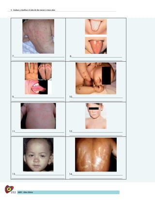 252 AIEPI - Libro Clínico
3 - Evaluar y clasificar el niño de dos meses a cinco años
7.____________________________________
______________________________________
8.____________________________________
______________________________________
9.____________________________________
______________________________________
10.____________________________________
______________________________________
11.___________________________________
______________________________________
12.____________________________________
______________________________________
13.___________________________________
______________________________________
14.____________________________________
______________________________________
 