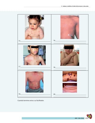 253AIEPI - Libro Clínico
3 - Evaluar y clasificar el niño de dos meses a cinco años
15.___________________________________
______________________________________
16.____________________________________
______________________________________
17.___________________________________
______________________________________
18.____________________________________
______________________________________
19.___________________________________
______________________________________
20.____________________________________
______________________________________
Cuando termine avise a su facilitador.
 