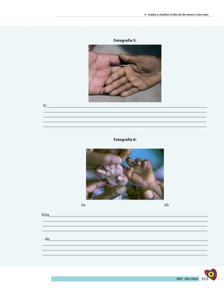 353AIEPI - Libro Clínico
3 - Evaluar y clasificar el niño de dos meses a cinco años
Fotografía 5:
R/________________________________________________________________________________
_________________________________________________________________________________
_________________________________________________________________________________
_________________________________________________________________________________
_________________________________________________________________________________
Fotografía 6:
6a 6b
R/6a_______________________________________________________________________________
__________________________________________________________________________________
__________________________________________________________________________________
__________________________________________________________________________________
6b_______________________________________________________________________________
__________________________________________________________________________________
__________________________________________________________________________________
__________________________________________________________________________________
 