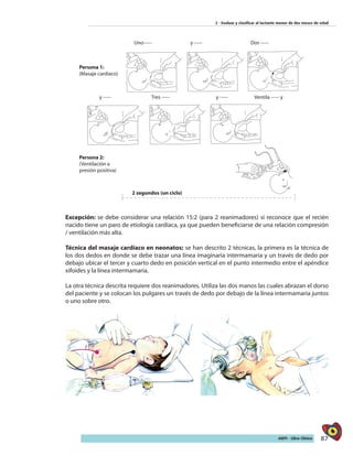 87AIEPI - Libro Clínico
2 - Evaluar y clasificar al lactante menor de dos meses de edad
Excepción: se debe considerar una relación 15:2 (para 2 reanimadores) si reconoce que el recién
nacido tiene un paro de etiología cardíaca, ya que pueden beneficiarse de una relación compresión
/ ventilación más alta.
Técnica del masaje cardíaco en neonatos: se han descrito 2 técnicas, la primera es la técnica de
los dos dedos en donde se debe trazar una línea imaginaria intermamaria y un través de dedo por
debajo ubicar el tercer y cuarto dedo en posición vertical en el punto intermedio entre el apéndice
xifoides y la línea intermamaria.
La otra técnica descrita requiere dos reanimadores. Utiliza las dos manos las cuales abrazan el dorso
del paciente y se colocan los pulgares un través de dedo por debajo de la línea intermamaria juntos
o uno sobre otro.
 