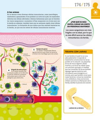 174 175
A las armas
En la dermis viven diversas células inmunitarias, como macrófagos,
mastocitos y granulocitos. Si se produce un corte en la piel, los mastocitos
detectan las células afectadas y liberan histaminas para que se hinchen
los vasos sanguíneos y aumentar el flujo sanguíneo en el área (por eso
la herida se calienta); también hace que se acerquen rápido otras células
inmunitarias. La formación de pus indica que han entrado bacterias en
la herida, ya que son los restos de células inmunitarias muertas.
Si una herida en la piel no se cura
adecuadamente ni responde al
tratamiento convencional, las larvas
pueden ser la solución. Las pequeñas
larvas de mosca digieren células
muertas y no tocan las células sanas
con precisión quirúrgica. A medida
que van comiendo, las larvas también
segregan agentes químicos anti­
microbianos para protegerse a sí
mismas, pero que también sirven para
matar bacterias, incluso las resistentes
a los antibióticos. Estas secreciones
inhiben asimismo la inflamación de la
herida y facilitan el proceso de curación.
TERAPIA CON LARVAS
LARVAS DE LA MOSCA
Célula T
Célula B
Célula B
Célula T
Brigada de anticuerpos
Si el cuerpo necesita más
ayuda para acabar con la infección,
se acercan células B y producen
anticuerpos que se unen a los
patógenos para destruirlos.
Equipo de apoyo
Las células T desplazadas liberan
agentes químicos que matan las bacterias
e indican a los macrófagos que se las coman.
4
5
Célula B
en el plasma
Anticuerpo
¿POR QUÉ ES MÁS
DIFÍCIL CURAR UN CORTE
EN PERSONAS MAYORES?
Los vasos sanguíneos son más
frágiles con la edad, por lo que
es más difícil acercar las células
inmunitarias a la herida.
 