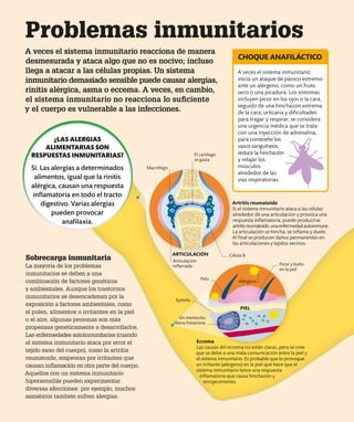 Problemas inmunitarios
A veces el sistema inmunitario reacciona de manera
desmesurada y ataca algo que no es nocivo; incluso
llega a atacar a las células propias. Un sistema
inmunitario demasiado sensible puede causar alergias,
rinitis alérgica, asma o eccema. A veces, en cambio,
el sistema inmunitario no reacciona lo suficiente
y el cuerpo es vulnerable a las infecciones.
Sobrecarga inmunitaria
La mayoría de los problemas
inmunitarios se deben a una
combinación de factores genéticos
y ambientales. Aunque los trastornos
inmunitarios se desencadenan por la
exposición a factores ambientales, como
el polen, alimentos o irritantes en la piel
o el aire, algunas personas son más
propensas genéticamente a desarrollarlos.
Las enfermedades autoinmunitarias (cuando
el sistema inmunitario ataca por error el
tejido sano del cuerpo), como la artritis
reumatoide, empeoran por irritantes que
causan inflamación en otra parte del cuerpo.
Aquellos con un sistema inmunitario
hipersensible pueden experimentar
diversas afecciones: por ejemplo, muchos
asmáticos también sufren alergias.
A veces el sistema inmunitario
inicia un ataque de pánico extremo
ante un alérgeno, como un fruto
seco o una picadura. Los síntomas
incluyen picor en los ojos o la cara,
seguido de una hinchazón extrema
de la cara, urticaria y dificultades
para tragar y respirar; se considera
una urgencia médica que se trata
con una inyección de adrenalina,
para constreñir los
vasos sanguíneos,
reducir la hinchazón
y relajar los
músculos
alrededor de las
vías respiratorias.
CHOQUE ANAFILÁCTICO
Artritis reumatoide
Si el sistema inmunitario ataca a las células
alrededor de una articulación y provoca una
respuesta inflamatoria, puede producirse
artritisreumatoide,unaenfermedadautoinmune.
La articulación se hincha, se inflama y duele.
Al final se producen daños permanentes en
las articulaciones y tejidos vecinos.
Eccema
Las causas del eccema no están claras, pero se cree
que se debe a una mala comunicación entre la piel y
el sistema inmunitario. Es probable que lo provoque
un irritante (alérgeno) en la piel que hace que el
sistema inmunitario lance una respuesta
inflamatoria que causa hinchazón y
enrojecimiento.
Alérgeno
PIEL
ARTICULACIÓN
¿LAS ALERGIAS
ALIMENTARIAS SON
RESPUESTAS INMUNITARIAS?
Sí. Las alergias a determinados
alimentos, igual que la rinitis
alérgica, causan una respuesta
inflamatoria en todo el tracto
digestivo. Varias alergias
pueden provocar
anafilaxia.
Célula B
Pelo
Epitelio
Picor y bulto
en la piel
Macrófago
Articulación
inflamada
El cartílago
se gasta
Un mastocito
libera histamina
 