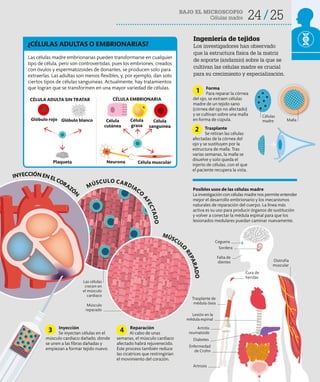 24 25
BAJO EL MICROSCOPIO
Células madre
MÚSCULO CARDIACO
A
F
E
C
T
A
D
O
Ingeniería de tejidos
Los investigadores han observado
que la estructura física de la matriz
de soporte (andamio) sobre la que se
cultivan las células madre es crucial
para su crecimiento y especialización.
Posibles usos de las células madre
La investigación con células madre nos permite entender
mejor el desarrollo embrionario y los mecanismos
naturales de reparación del cuerpo. La línea más
activa es su uso para producir órganos de sustitución
y volver a conectar la médula espinal para que los
lesionados medulares puedan caminar nuevamente.
Las células madre embrionarias pueden transformarse en cualquier
tipo de célula, pero son controvertidas, pues los embriones, creados
con óvulos y espermatozoides de donantes, se producen solo para
extraerlas. Las adultas son menos flexibles, y, por ejemplo, dan solo
ciertos tipos de células sanguíneas. Actualmente, hay tratamientos
que logran que se transformen en una mayor variedad de células.
¿CÉLULAS ADULTAS O EMBRIONARIAS?
CÉLULA ADULTA SIN TRATAR CÉLULA EMBRIONARIA
Célula
cutánea
Neurona Célula muscular
Célula
grasa
Célula
sanguínea
Glóbulo rojo Glóbulo blanco
Plaqueta
Ceguera
Sordera
Falta de
dientes
Cura de
heridas
Lesión en la
médula espinal
Trasplante de
médula ósea
Artrosis
Artritis
reumatoide
Enfermedad
de Crohn
Distrofia
muscular
Forma
Para reparar la córnea
del ojo, se extraen células
madre de un tejido sano
(córnea del ojo no afectado)
y se cultivan sobre una malla
en forma de cúpula.
Trasplante
Se retiran las células
afectadas de la córnea del
ojo y se sustituyen por la
estructura de malla. Tras
varias semanas, la malla se
disuelve y solo queda el
injerto de células, con el que
el paciente recupera la vista.
Reparación
Al cabo de unas
semanas, el músculo cardiaco
afectado habrá rejuvenecido.
Este proceso también reduce
las cicatrices que restringirían
el movimiento del corazón.
Inyección
Se inyectan células en el
músculo cardiaco dañado, donde
se unen a las fibras dañadas y
empiezan a formar tejido nuevo.
1
2
4
3
MÚSCUL
O
R
E
P
A
R
A
D
O
Músculo
reparado
Las células
crecen en
el músculo
cardiaco
INYECCIÓNENELCORAZÓ
N
Diabetes
Células
madre Malla
 