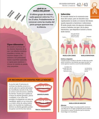 42 43
UN BUEN SOPORTE
Morder y masticar
¿QUÉ ES LA
MUELA DEL JUICIO?
El último grupo de molares
suele aparecer entre los 17 y
los 25 años. Probablemente se
conozcan como las muelas del
juicio porque aparecen tras
la infancia.
Tipos diferentes
El tamaño y la forma de
los dientes depende de su
uso. Los afilados incisivos
muerden y cortan, los
caninos rasgan y los
molares y los premolares
tienen superficie aplanada
y rugosa para masticar y
triturar la comida en piezas
muy pequeñas.
Infección
El esmalte dental es la sustancia más
dura del cuerpo, pero se disuelve muy
rápidamente en ácido y el interior del diente
queda expuesto a bacterias e infecciones.
El ácido puede venir de algunos alimentos,
zumos y bebidas con gas o de la placa
bacteriana, que degrada el azúcar y forma
ácido láctico.
MUELA CON CARIES MUELAEMPASTADA
MUELA CON UN ABSCESO
Caries y empastes
Cuando el duro esmalte se disuelve, la infección puede
pudrir la dentina, más blanda, que aquel recubre. La
caries aparece cuando se cae el esmalte debilitado.
Absceso
Si las bacterias llegan a la pulpa pueden provocar
una infección en un lugar complicado para el sistema
inmunitario y causar un absceso que se extienda
hasta llegar a la mandíbula.
La pulpa y los
canales de la raíz
están llenos de
bacterias y pus
Las bacterias
entran por la
grieta
Zona del diente
a perforar para
retirar la caries Empaste
Caries
I
N
C
I
S
I
V
O
C
E
N
T
R
A
L
I
N
C
I
S
I
V
O
L
A
T
E
R
A
L
C
A
N
I
N
O
A una de cada 12 personas le
rechinan los dientes al dormir, y
una de cada cinco aprieta demasiado
las mandíbulas durante el día. Esto
se conoce como bruxismo y debilita
los dientes. Puede que lo padezcas
si tienes los dientes gastados, planos
o astillados, si los notas más
sensibles o te despiertas con dolor de
mandíbula, rigidez en sus músculos
o un dolor sordo de cabeza (sobre
todo si te muerdes las mejillas por
dentro). Los dientes gastados pueden
recuperar una forma más natural.
¿TE RECHINAN LOS DIENTES POR LA NOCHE?
DIENTES PLANOS
TRAS EL TRATAMIENTO
 