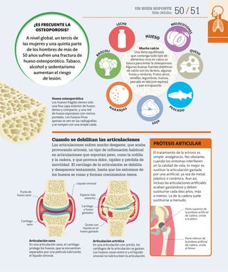 UN BUEN SOPORTE
Más débiles 50 51
Cuando se debilitan las articulaciones
Las articulaciones sufren mucho desgaste, que acaba
provocando artrosis, un tipo de inflamación habitual
en articulaciones que soportan peso, como la rodilla
y la cadera, y que provoca dolor, rigidez y pérdida de
movilidad. El cartílago de la articulación se debilita
y desaparece lentamente, hasta que los extremos de
los huesos se rozan y forman crecimientos óseos.
El tratamiento de la artrosis es
simple: analgésicos. No obstante,
cuando los síntomas interfieren
en la calidad de vida, lo mejor es
sustituir la articulación gastada
por una artificial, ya sea de metal,
plástico o cerámica. Aun así,
incluso las articulaciones artificiales
acaban gastándose y deben
sustituirse cada diez años, más
o menos. La de la cadera suele
sustituirse a menudo.
PRÓTESIS ARTICULAR
Mucho calcio
Una dieta equilibrada
que contenga todo tipo de
alimentos ricos en calcio es
básica para evitar la osteoporosis.
Algunas buenas fuentes dietéticas
de calcio son los lácteos, algunas
frutas y verduras, frutos secos,
semillas, legumbres, huevos,
pescado en lata (con espinas)
y pan enriquecido.
Articulación artrítica
En una articulación con artritis, los
cartílagos de la articulación se gastan.
Los huesos rozan entre sí y el líquido
sinovial no lubrica bien la articulación.
Articulación sana
En una articulación sana, el cartílago
protege los huesos, que se encuentran
separados por una película lubricante,
el líquido sinovial.
Parte superior de
la prótesis artificial
de cadera, unida
a la pelvis
Parte inferior de
la prótesis artificial
de cadera, unida
al fémur
Punta de
hueso sano
Cartílago
sano
Líquido sinovial
Espacio más
estrecho
Cartílago
y hueso
gastados
Hueso osteoporótico
Los huesos frágiles tienen solo
una fina capa exterior de hueso
denso y compacto, y una red
de hueso esponjoso con menos
puntales. Los huesos finos
apenas se ven en las radiografías
y se rompen con una simple caída.
Quiste con
líquido en el
hueso gastado
¿ES FRECUENTE LA
OSTEOPOROSIS?
A nivel global, un tercio de
las mujeres y una quinta parte
de los hombres de más de
50 años sufren una fractura de
hueso osteoporótico. Tabaco,
alcohol y sedentarismo
aumentan el riesgo
de lesión.
N
ARANJAS
SOJA
PESCADO
B
RÓCOLI
LECHE MELOCOTO
N
E
S
QUESO
HUESO
 
