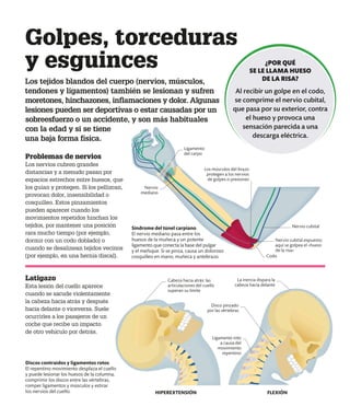Golpes, torceduras
y esguinces
Los tejidos blandos del cuerpo (nervios, músculos,
tendones y ligamentos) también se lesionan y sufren
moretones, hinchazones, inflamaciones y dolor. Algunas
lesiones pueden ser deportivas o estar causadas por un
sobreesfuerzo o un accidente, y son más habituales
con la edad y si se tiene
una baja forma física.
Problemas de nervios
Los nervios cubren grandes
distancias y a menudo pasan por
espacios estrechos entre huesos, que
los guían y protegen. Si los pellizcan,
provocan dolor, insensibilidad o
cosquilleo. Estos pinzamientos
pueden aparecer cuando los
movimientos repetidos hinchan los
tejidos, por mantener una posición
rara mucho tiempo (por ejemplo,
dormir con un codo doblado) o
cuando se desalinean tejidos vecinos
(por ejemplo, en una hernia discal).
Latigazo
Esta lesión del cuello aparece
cuando se sacude violentamente
la cabeza hacia atrás y después
hacia delante o viceversa. Suele
ocurrirles a los pasajeros de un
coche que recibe un impacto
de otro vehículo por detrás.
Síndrome del túnel carpiano
El nervio mediano pasa entre los
huesos de la muñeca y un potente
ligamento que conecta la base del pulgar
y el meñique. Si se pinza, causa un doloroso
cosquilleo en mano, muñeca y antebrazo.
Discos contraídos y ligamentos rotos
El repentino movimiento desplaza el cuello
y puede lesionar los huesos de la columna,
comprimir los discos entre las vértebras,
romper ligamentos y músculos y estirar
los nervios del cuello.
Codo
Nervio cubital
Los músculos del brazo
protegen a los nervios
de golpes o presiones
Ligamento
del carpo
¿POR QUÉ
SE LE LLAMA HUESO
DE LA RISA?
Al recibir un golpe en el codo,
se comprime el nervio cubital,
que pasa por su exterior, contra
el hueso y provoca una
sensación parecida a una
descarga eléctrica.
HIPEREXTENSIÓN FLEXIÓN
Disco pinzado
por las vértebras
Ligamento roto
a causa del
movimiento
repentino
Cabeza hacia atrás: las
articulaciones del cuello
superan su límite
La inercia dispara la
cabeza hacia delante
Nervio cubital expuesto;
aquí se golpea el «hueso
de la risa»
Nervio
mediano
 