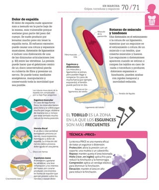 EN MARCHA
Golpes, torceduras y esguinces 70 71
Roturas de músculo
y tendones
Una distensión es el estiramiento
o la rotura de un ligamento,
mientras que un esguince es
el estiramiento o rotura de un
músculo o un tendón, que
conecta músculos y huesos.
Los esguinces o distensiones
aparecen cuando se estiran o
rompen los tejidos en caso de
caída o torcedura y producen
dolorosos espasmos e
hinchazón; pueden acabar
con rigidez temporal y
movilidad reducida.
EL TOBILLO ES LA ZONA
EN LA QUE LOS ESGUINCES
SON MÁS FRECUENTES
Esguinces y
distensiones
Los músculos y
ligamentos se estiran,
pero pueden llegar a
romperse. En casos de
mucha fuerza (por ejemplo,
esquiando), el tendón
puede partirse en dos.
Ligamento del tobillo
Músculo
de la
pantorrilla
Tendón de Aquiles
Fibra muscular
rota
Roturas en los
ligamentos del tobillo
Dolor de espalda
El dolor de espalda suele aparecer
más a menudo en la parte baja de
la misma, más vulnerable porque
sostiene gran parte del peso del
cuerpo. Se suele producir por
levantar mucho peso sin tener la
espalda recta. El esfuerzo excesivo
puede causar una rotura y espasmos
musculares, distensión de ligamentos
e incluso una dislocación de una
de las diminutas articulaciones (ver
p. 40) entre las vértebras. La presión
puede hacer que el gelatinoso centro
de un disco intervertebral pierda
su cubierta de fibra y presione un
nervio. Se puede tratar mediante
analgésicos, manipulación y
conservando toda la movilidad que
sea posible.
Las roturas musculares de la
espalda son complicadas
por su bajo flujo sanguíneo
Esguince muscular
En caso de baja forma
física, los músculos tienen
poco tono y se sobrecargan
mucho por cargar, doblarse
de manera rara o incluso
por estar sentado mucho
rato en la misma posición.
Hernia discal
Si un disco intervertebral
estropeado presiona un
nervio, causa espasmos,
hormigueo y dolor de
espalda. La irritación del
nervio ciático provoca
dolor agudo en una pierna.
Espolones óseos
Al envejecer y gastarse
las vértebras, una leve
inflamación y los intentos
del hueso por curarse
producen crecimientos
en forma de espolón que
ejercen presión sobre los
nervios y causan dolor.
La técnica PRICE es una manera eficaz
de tratar un esguince o distensión:
Protección: alivia la presión con un
soporte, una muleta o un cabestrillo.
Reposo: mantén quieta el área lesionada.
Hielo («ice», en inglés): aplica frío para
reducir la hinchazón y la hemorragia.
Compresión: aplica un vendaje elástico
para disminuir la hinchazón.
Elevación: mantén el área en alto
para reducir la hinchazón.
Disco con hernia
Crecimiento óseo
TÉCNICA «PRICE»
 