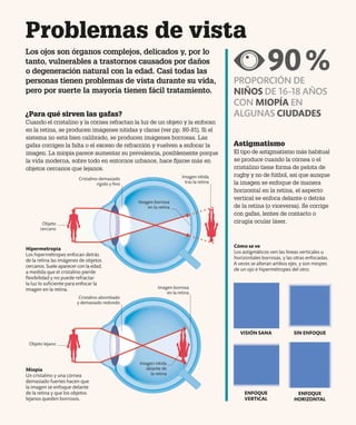 Hipermetropía
Los hipermétropes enfocan detrás
de la retina las imágenes de objetos
cercanos. Suele aparecer con la edad,
a medida que el cristalino pierde
flexibilidad y no puede refractar
la luz lo suficiente para enfocar la
imagen en la retina.
Problemas de vista
Los ojos son órganos complejos, delicados y, por lo
tanto, vulnerables a trastornos causados por daños
o degeneración natural con la edad. Casi todas las
personas tienen problemas de vista durante su vida,
pero por suerte la mayoría tienen fácil tratamiento.
¿Para qué sirven las gafas?
Cuando el cristalino y la córnea refractan la luz de un objeto y la enfocan
en la retina, se producen imágenes nítidas y claras (ver pp. 80-81). Si el
sistema no está bien calibrado, se producen imágenes borrosas. Las
gafas corrigen la falta o el exceso de refracción y vuelven a enfocar la
imagen. La miopía parece aumentar su prevalencia, posiblemente porque
la vida moderna, sobre todo en entornos urbanos, hace fijarse más en
objetos cercanos que lejanos.
Astigmatismo
El tipo de astigmatismo más habitual
se produce cuando la córnea o el
cristalino tiene forma de pelota de
rugby y no de fútbol, así que aunque
la imagen se enfoque de manera
horizontal en la retina, el aspecto
vertical se enfoca delante o detrás
de la retina (o viceversa). Se corrige
con gafas, lentes de contacto o
cirugía ocular láser.
Cómo se ve
Los astigmáticos ven las líneas verticales u
horizontales borrosas, y las otras enfocadas.
A veces se alteran ambos ejes, y son miopes
de un ojo e hipermétropes del otro.
VISIÓN SANA
ENFOQUE
VERTICAL
SIN ENFOQUE
ENFOQUE
HORIZONTAL
90%
PROPORCIÓN DE
NIÑOS DE 16-18 AÑOS
CON MIOPÍA EN
ALGUNAS CIUDADES
Imagen nítida
tras la retina
Objeto
cercano
Imagen borrosa
en la retina
Miopía
Un cristalino y una córnea
demasiado fuertes hacen que
la imagen se enfoque delante
de la retina y que los objetos
lejanos queden borrosos.
Objeto lejano
Imagen borrosa
en la retina
Imagen nítida
delante de
la retina
Cristalino demasiado
rígido y fino
Cristalino abombado
y demasiado redondo
 