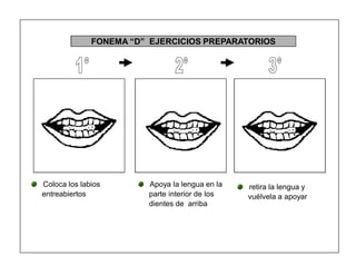 34
FONEMA ³D´ EJERCICIOS PREPARATORIOS
Coloca los labios
entreabiertos
Apoya la lengua en la
parte interior de los
dientes de arriba
retira la lengua y
vuélvela a apoyar
 