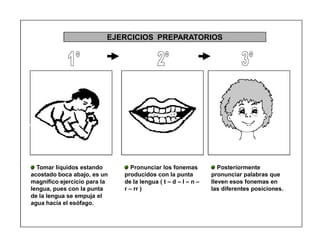 35
EJERCICIOS PREPARATORIOS
Tomar líquidos estando
acostado boca abajo, es un
magnifico ejercicio para la
lengua, pues con la punta
de la lengua se empuja el
agua hacia el esófago.
Pronunciar los fonemas
producidos con la punta
de la lengua ( t ± d ± l ± n ±
r ± rr )
Posteriormente
pronunciar palabras que
lleven esos fonemas en
las diferentes posiciones.
 
