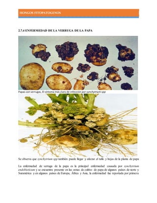 HONGOS FITOPATOGENOS
2.7.4 ENFERMEDAD DE LA VERRUGA DE LA PAPA
Papas con verrugas, El síntoma más claro de infección por synchytrium spp
Se observa que synchytrium spp también puede llegar y afectar el tallo y hojas de la planta de papa
La enfermedad de verruga de la papa es la principal enfermedad causada por synchytrium
endobioticum y se encuentra presente en las zonas de cultivo de papa de algunos países de norte y
Suramérica y en algunos países de Europa, África y Asia, la enfermedad fue reportada por primera
 