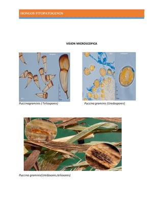 HONGOS FITOPATOGENOS
VISION MICROSCOPICA
Puccinagraminis ( Teliospores) Puccina graminis (Uredospores)
Puccina graminis(Uredosores,teliosores)
 