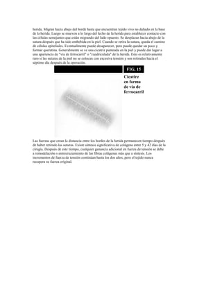 herida. Migran hacia abajo del borde hasta que encuentran tejido vivo no dañado en la base
de la herida. Luego se mueven a lo largo del lecho de la herida para establecer contacto con
las células semejantes que están migrando del lado opuesto. Se desplazan hacia abajo de la
sutura después que ha sido embebida en la piel. Cuando se retira la sutura, queda el camino
de células epiteliales. Eventualmente puede desaparecer, pero puede quedar un poco y
formar queratina. Generalmente se ve una cicatriz punteada en la piel y puede dar lugar a
una apariencia de "vía de ferrocarril" o "cuadriculada" de la herida. Esto es relativamente
raro si las suturas de la piel no se colocan con excesiva tensión y son retiradas hacia el
séptimo día después de la operación.
FIG. 15
Cicatirz
en forma
de vía de
ferrocarril
Las fuerzas que crean la distancia entre los bordes de la herida permanecen tiempo después
de haber retirado las suturas. Existe síntesis significativa de colágena entre 5 y 42 días de la
cirugía. Después de este tiempo, cualquier ganancia adicional en fuerza de tensión se debe
a remodelación o entrecruzamiento de las fibras colágenas más que a síntesis. Los
incrementos de fuerza de tensión continúan hasta los dos años, pero el tejido nunca
recupera su fuerza original.
 
