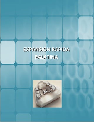 EXPANSION RAPIDA
    PALATINA
 
