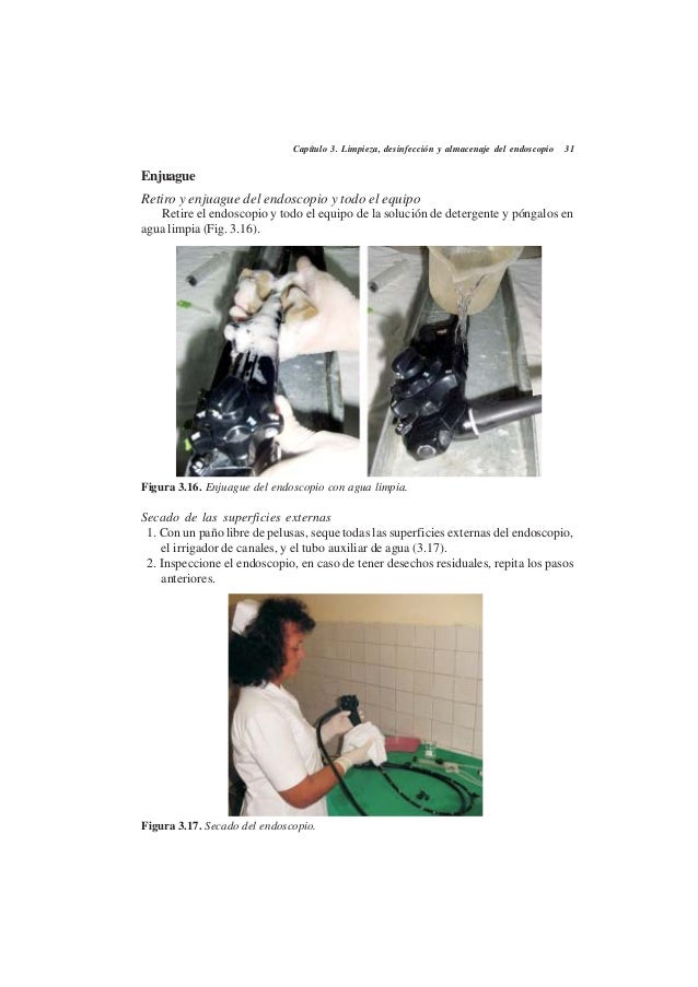 tomar agua antes da endoscopia tomar agua antes da endoscopia