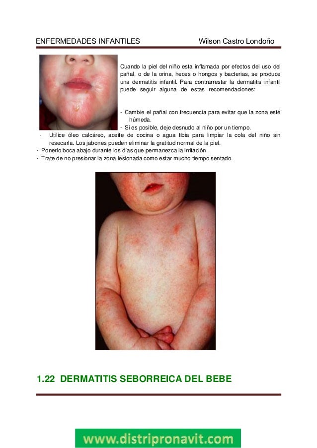 Curar la psoriasis en las orejas