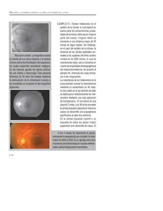 Mácula en celofán: La fotografía muestra
la mácula de una retina hipóxica y la hipoxia
crónica activa los fibroblastos del organismo,
los cuales responden secretando colágeno.
En las hipoxias agudas los signos cardina-
les son edema y hemorragia. Esta paciente
femenina de 58 años fue tratada mediante
la estimulación de la fotosíntesis humana y
los resultados se muestran en las fotografías
siguientes:
EJEMPLO 51.- Existen melanocitos en el
epitelio de la córnea, lo cual explica en
buena parte las extraordinarias propie-
dades de la misma, dado que en ninguna
parte del cuerpo, ninguna célula se
encuentra a una distancia mayor de 30
micras de algún capilar. Sin embargo,
en el caso del epitelio de la córnea, la
distancia de las células epiteliales cor-
neales a los capilares del limbo esclero
corneal es de 5500 micras, lo cual es
notoriamente mayor, pero si tomamos en
cuenta las propiedades antiangiogénicas
del melanocito/melanina, de acuerdo al
ejemplo 46, entonces las cosas empie-
zan a ser congruentes.
La importancia de los melanocitos en la
avascularidad corneal la demostramos
mediante un experimento en 40 ratas,
en las cuales en el ojo derecho de ellas
se destruyeron selectivamente los mel-
anocitos mediante una sola aplicación
de hidrobenzeno, 10 microlitros de una
solución 2 molar, y en 36 de los animales
la córnea expuesta (derecha en todos los
casos) se desarrolló una angiogénesis
significativa al cabo dos semanas.
En la córnea izquierda (control o no
expuesta en todos los casos) ningún
espécimen tuvo desarrollo de vasos. El
84
MELANINA, LA CLOROFILA HUMANA, SU PAPEL EN EL ORIGEN DE LA VIDA
A los 4 meses de tratamiento la gliosis
premacularhadesaparecidoporcompleto,lavisión
mejoróde20/40a20/20.Esunejemploclarodela
importanciadelafotosíntesisenmuchasenferme-
dades epidemiológicamente importantes.
 