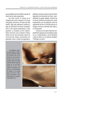 que es deletérea para el endotelio vascular (el
interior de los vasos sanguíneos).
De todos modos, el valioso es el
hidrógeno pero como el oxígeno es 16 veces
más grande, entonces es 16 veces más fácil
medirlo. Ojalá esta explicación contribuya a
dejar de administrar de manera compulsiva
hierro a las mujeres embarazadas y niños
pequeños. Lo considero un error colectivo.
Baste mencionar que la literatura médica
señala que las dos principales causas de
intoxicaciones fatales accidentales son
pesticidas y hierro. Cuando he preguntado a
Las imágenes superi-
ores demuestran la impor-
tancia del pigmento desde
los primeros días de la
formación del producto.
Existen datos muy par-
ticulares: el ojo (la coroides
específicamente) produce
sangre en las primeras
etapas de la vida. Otra
cuestión interesante es el
hecho de la concentración
de oxígeno en la sangre
fetal es del 45% e inme-
diato al nacimiento, dicha
concentración se iguala a
la del adulto: 97%.
91
IMPACTO DE LA FOTOSÍNTESIS HUMANA EN OTRAS ÁREAS DEL CONOCIMIENTO
pediatras conocidos cuántas veces han hecho
diagnóstico de intoxicación por hierro, invari-
ablemente se quedan callados. Inclusive hay
un artículo científico que empieza así: pocos
medicamentos son tan peligrosos como los
suplementos de hierro, la tercera parte de un
empaque normal es suficiente para matar a
un niño pequeño.
Creo que con los datos anteriores com-
prenderán la angustia que me embarga cuando
voy a un supermercado y veo los alimentos
y latas de leche con la leyenda resaltada:
“Fortificado con hierro”.
 