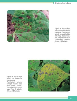 El Cultivo del Frejol en Bolivia
81
Figura 74. Hoja de frejol
(haz) con síntomas de man-
cha angular Phaeoisariopsis
griseola, Samaipata localidad
Valle Abajo (Valles Cruce-
ños), campaña verano 2011.
Programa Frejol, El Vallecito.
(Choque V. & Padilla J.).
Figura 75. Hoja de frejol
(envés), con síntomas de
mancha angular
Phaeoisariopsis griseola,
Samaipata localidad Valle
Abajo (Valles Cruceños),
campaña verano 2011. Pro-
grama Frejol, El Vallecito.
(Choque V. & Padilla J.).
 