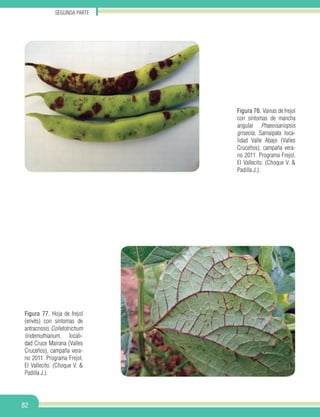 Segunda parte
82
Figura 76. Vainas de frejol
con síntomas de mancha
angular Phaeoisariopsis
griseola, Samaipata loca-
lidad Valle Abajo (Valles
Cruceños), campaña vera-
no 2011. Programa Frejol,
El Vallecito. (Choque V. &
Padilla J.).
Figura 77. Hoja de frejol
(envés) con síntomas de
antracnosis Colletotrichum
lindemuthianum, locali-
dad Cruce Mairana (Valles
Cruceños), campaña vera-
no 2011. Programa Frejol,
El Vallecito. (Choque V. &
Padilla J.).
 
