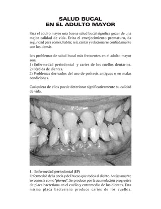SALUD BUCAL
           EN EL ADULTO MAYOR
Para el adulto mayor una buena salud bucal significa gozar de una
mejor calidad de vida. Evita el envejecimiento prematuro, da
seguridad para comer, hablar, reír, cantar y relacionarse confiadamente
con los demás.

Los problemas de salud bucal más frecuentes en el adulto mayor
son:
1) Enfermedad periodontal y caries de los cuellos dentarios.
2) Pérdida de dientes.
3) Problemas derivados del uso de prótesis antiguas o en malas
condiciones.

Cualquiera de ellos puede deteriorar significativamente su calidad
de vida.




1. Enfermedad periodontal (EP)
Enfermedad de la encía y del hueso que rodea al diente. Antiguamente
se conocía como "piorrea". Se produce por la acumulación progresiva
de placa bacteriana en el cuello y entremedio de los dientes. Esta
misma placa bacteriana produce caries de los cuellos.
 